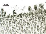 Dettaglio degli organi uniloculari